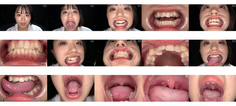 “Observation of the inside of the mouth, teeth, tongue tongue, and throat of a super cute and popular actress!!! Haru Kikuchi:Image