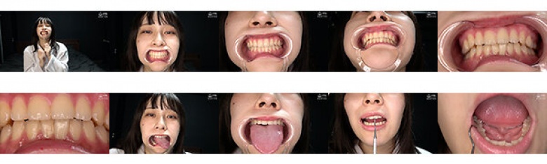 "Popular actress Suzune Kiritani's extremely rare observation of her mouth, teeth, and tongue!" Suzune Kiritani:Image