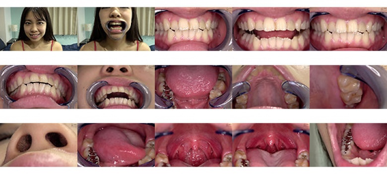 Tooth Fetish-Observation of uvula in teeth and mouth-Kaede Nagano:Image