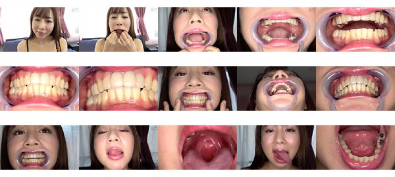 Teeth and mouth observation Iroha Narimiya:Image