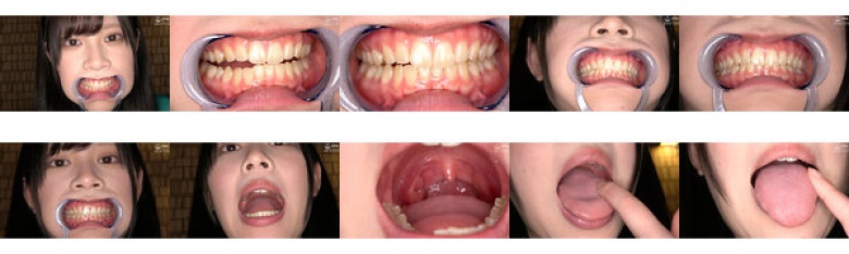 I observed the new model Emma's teeth, mouth, and tongue.Emma Nishioka:Image