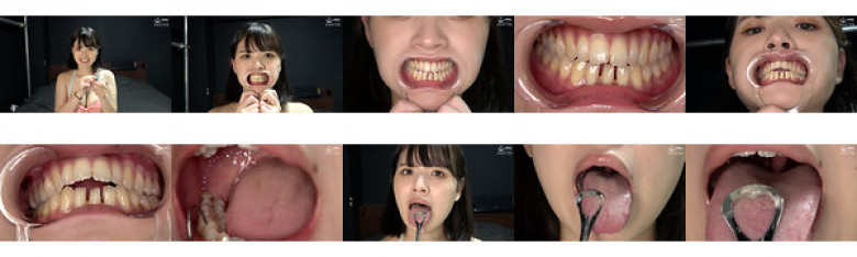 "[Teeth/Oral] Observation of popular model Amu Otoba's super rare teeth, mouth, and tongue tongue!" Amu Otoba:Image